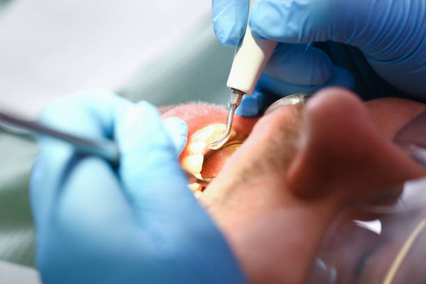 Best Weekend Emergency Dentist in Bladenboro, NC
