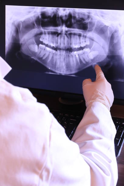 Best Emergency Dental Care for Broken or Chipped Teeth in Bladenboro, NC